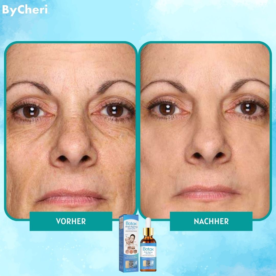 VivaLuxe™ — Unlock Youthful Radiance and Ditch Wrinkles Without Pain or Needles