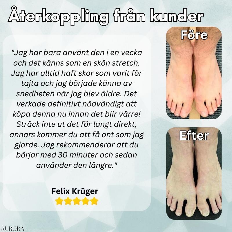 Bunion Correction Splint for Hallux Valgus