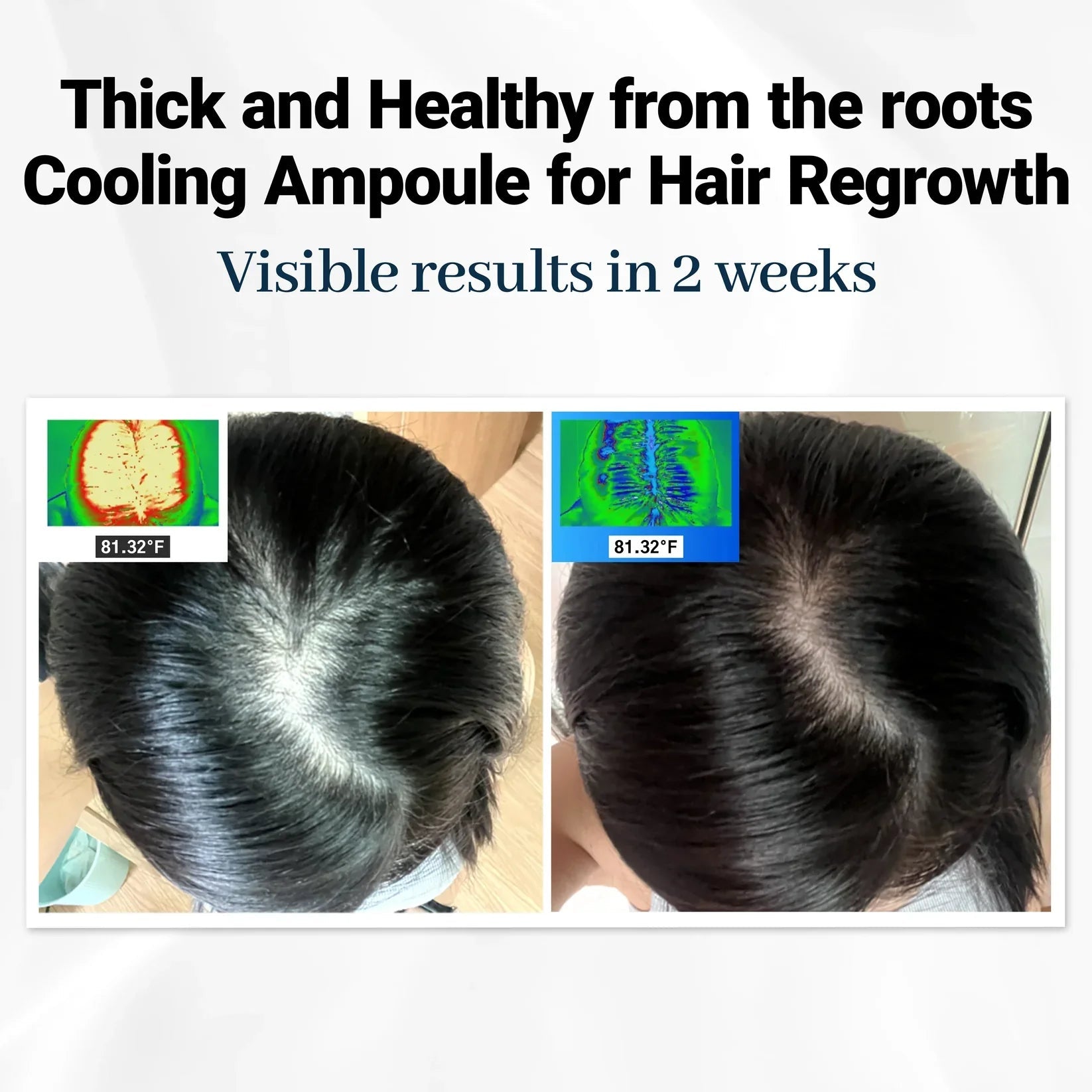 RevitaRoot™ — Wake Up to Thicker, Stronger Hair You Can Feel Every Day
