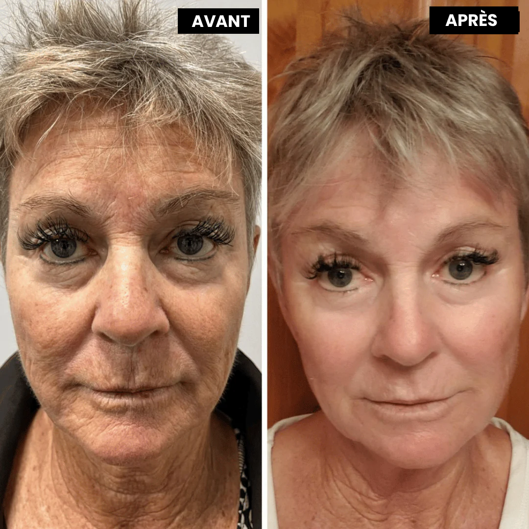 VitaFirm™ Duo — Unlock Firm, Radiant Skin That Turns Back Time