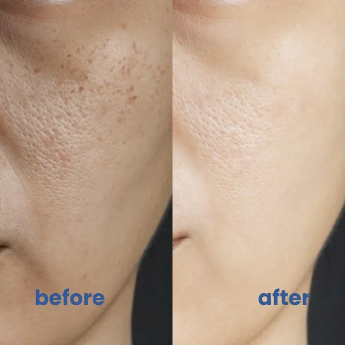 RadianceFlex™ — Unlock Silky, Redness-Free Radiance That Lasts All Day