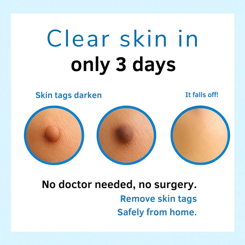 DermaluxePro™ — Effortlessly Erase Skin Tags for Smooth, Scar-Free Confidence