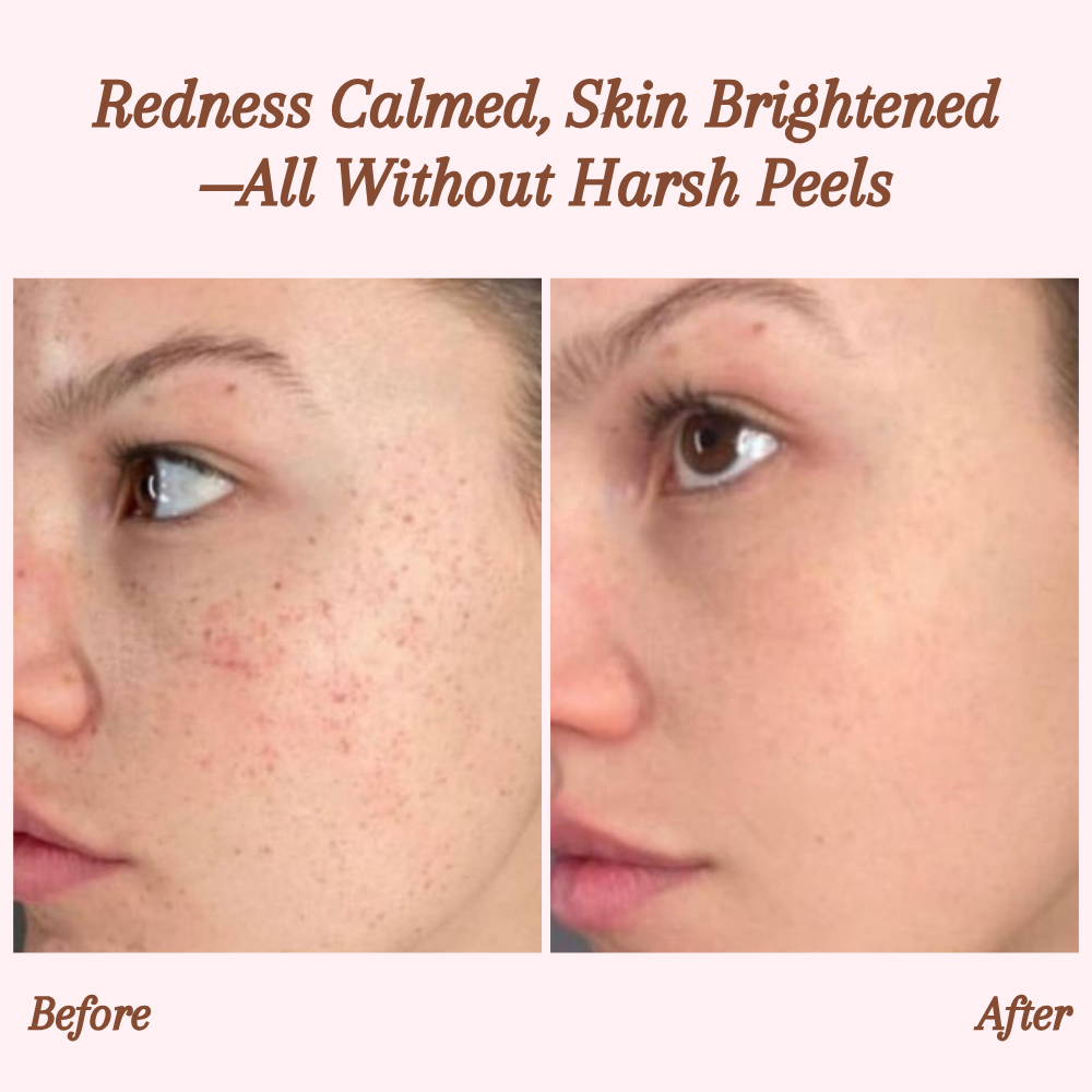 RevitaDerm™ — Unleash Radiant, Silky Skin and Banish Flaws for Good