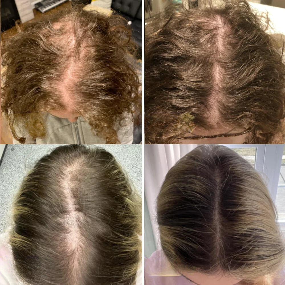 Arvilaro: Your natural oil for hair growth