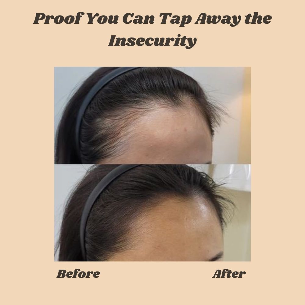 FolliBurst™ — Instantly Transform Thinning Hair into Full-Bodied Confidence