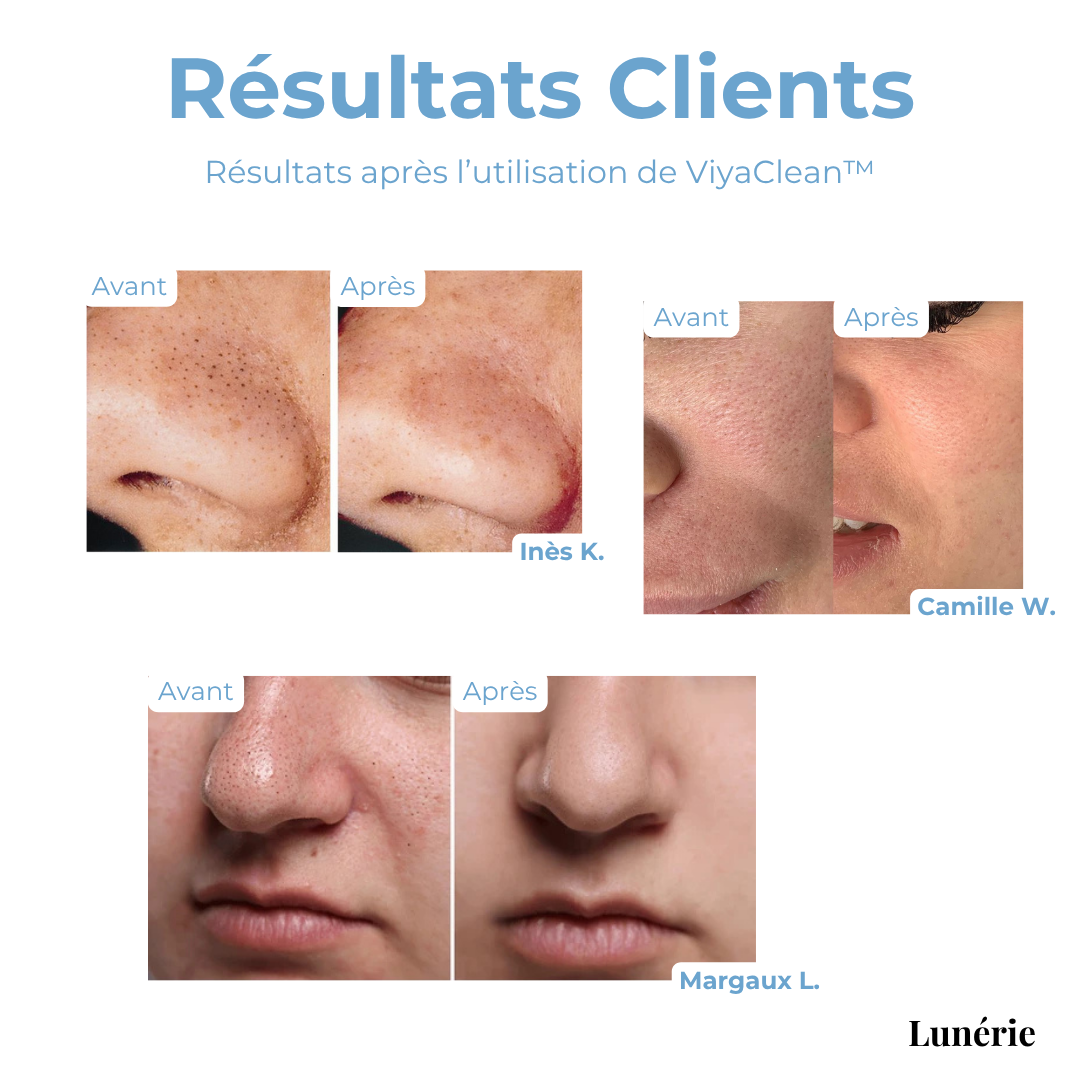 PurePore™ — Unlock Radiant, Blackhead-Free Skin You’ll Love to Touch