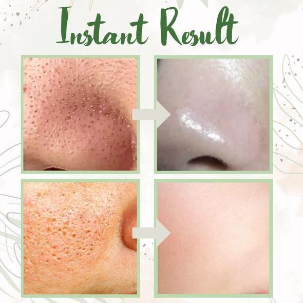 RadianceBoost™ — Unleash Your Skin’s Pure, Glowing Confidence Every Day