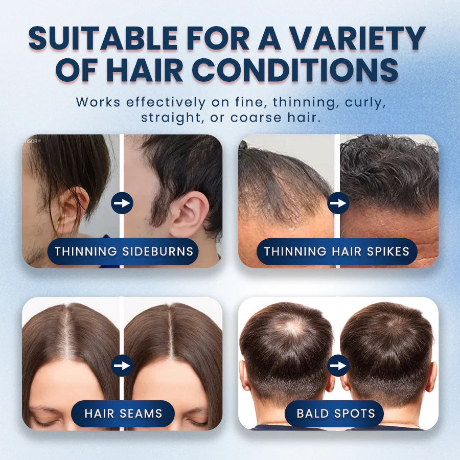 Buy One Get One Free | Instant Full Hair for Unlimited Confidence