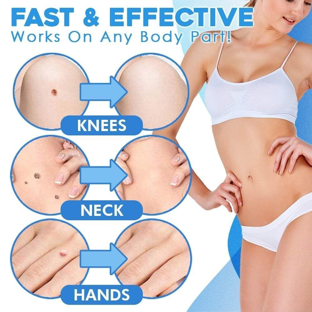 Dermatease™ — Reveal Smooth, Tag-Free Skin Without Pain or Hassle