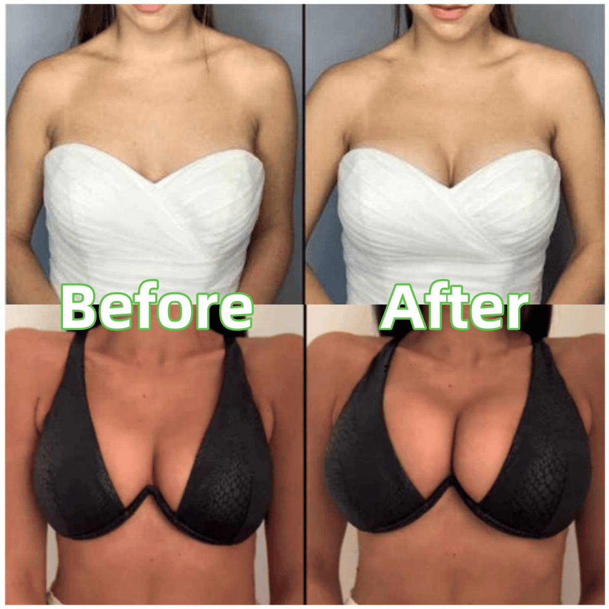 VoluSculpt™ — Unlock Irresistible Curves and Confidence Without a Single Pinch or Pull