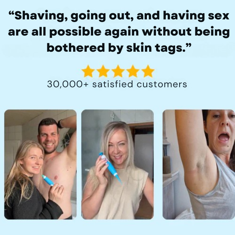 DermaluxePro™ — Effortlessly Erase Skin Tags for Smooth, Scar-Free Confidence