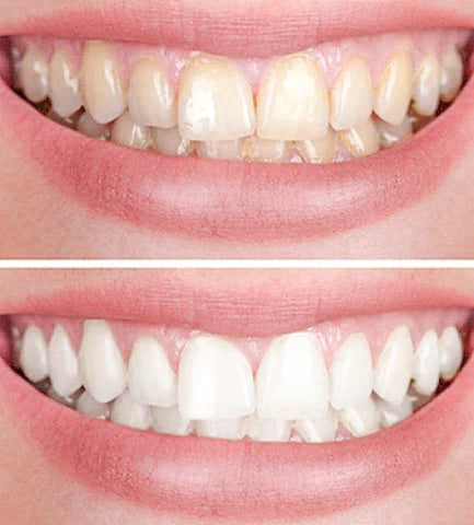 RadianceRush™ — Instantly Unleash Your Brightest, Most Confident Smile
