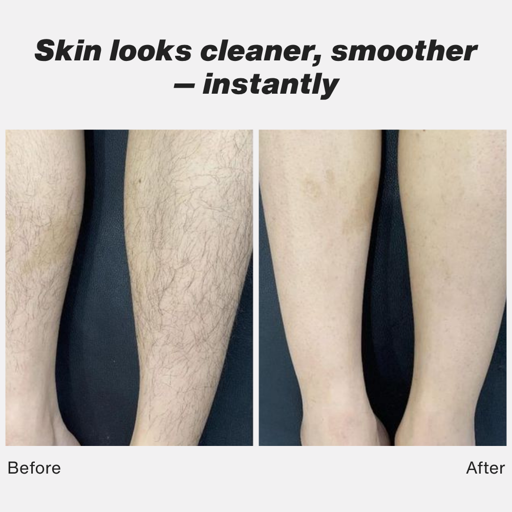 1X Lima Shave™ — Glide Into Every Curve for a Smooth, Irritation-Free Shave