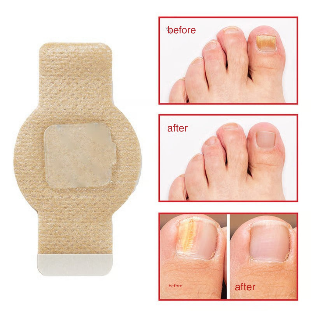 RevitaNail™ Patches — Finally Reveal Clear, Confident Nails Without the Hassle