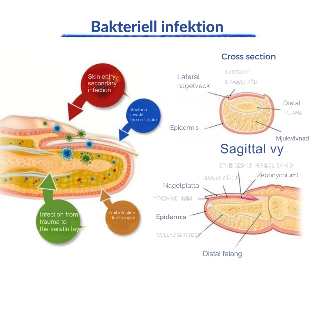 NailedIt™ | Say goodbye to thick, discolored nails without pain — no medication needed