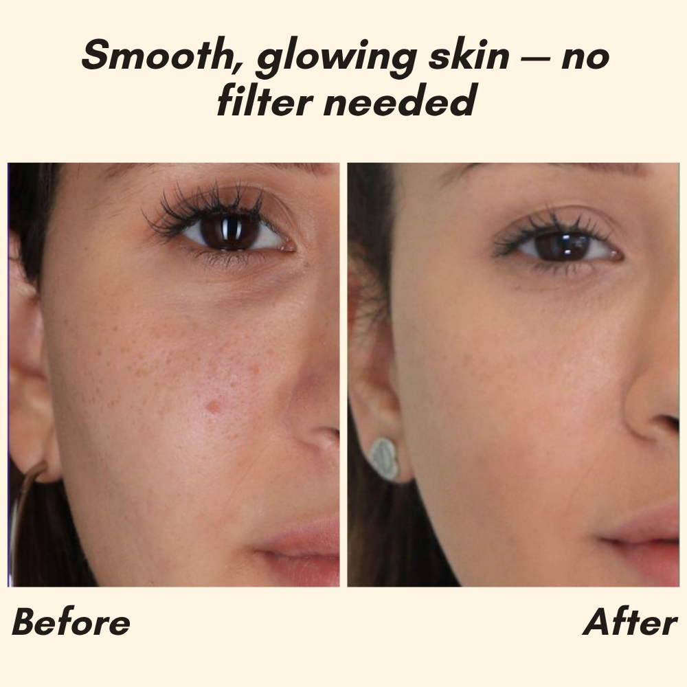 EELHOE Eternity™ — Erase Dark Spots, Reveal Glowing Skin | 1+1 FREE