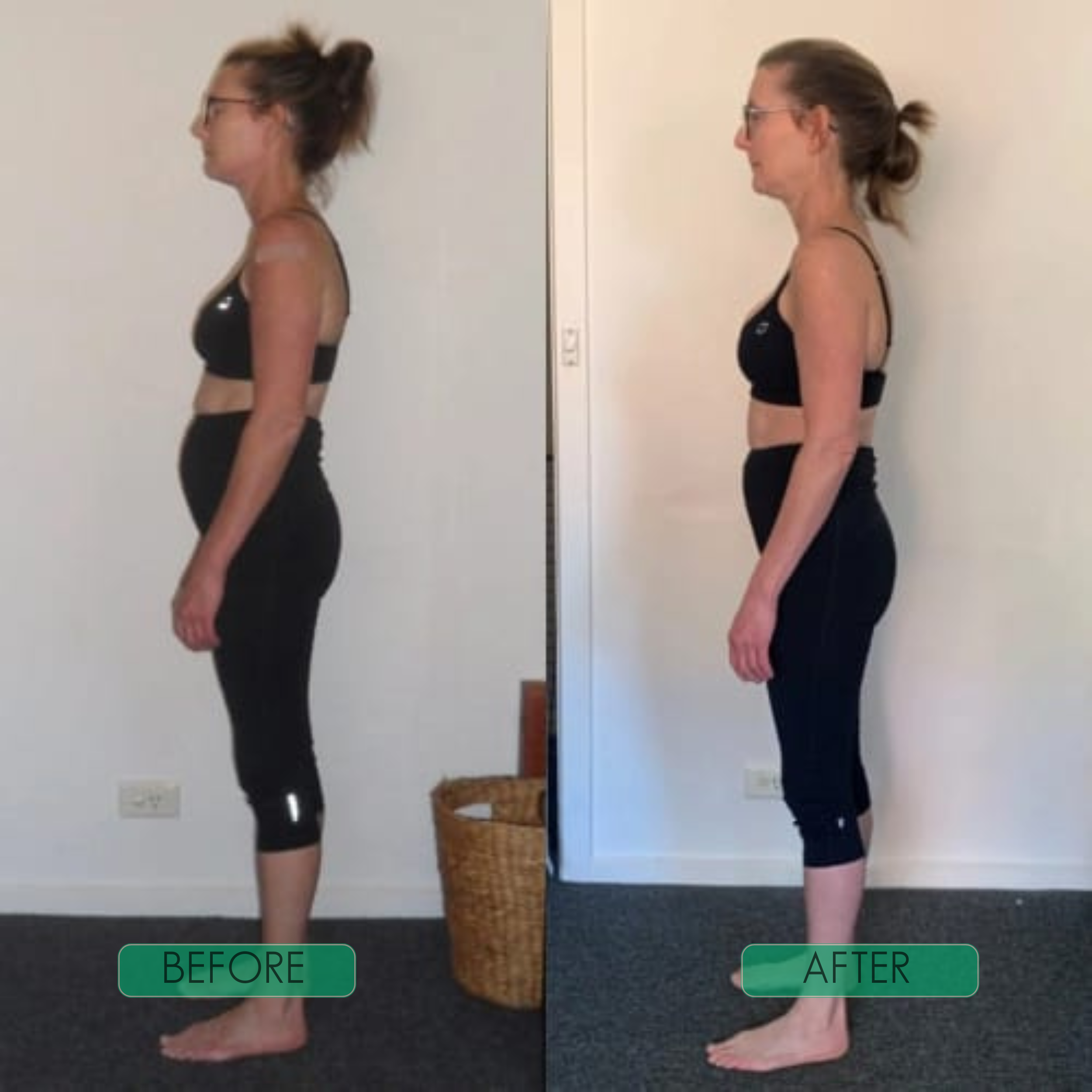 SpineAlign™ — Feel Taller and Pain-Free with All-Day Comfort