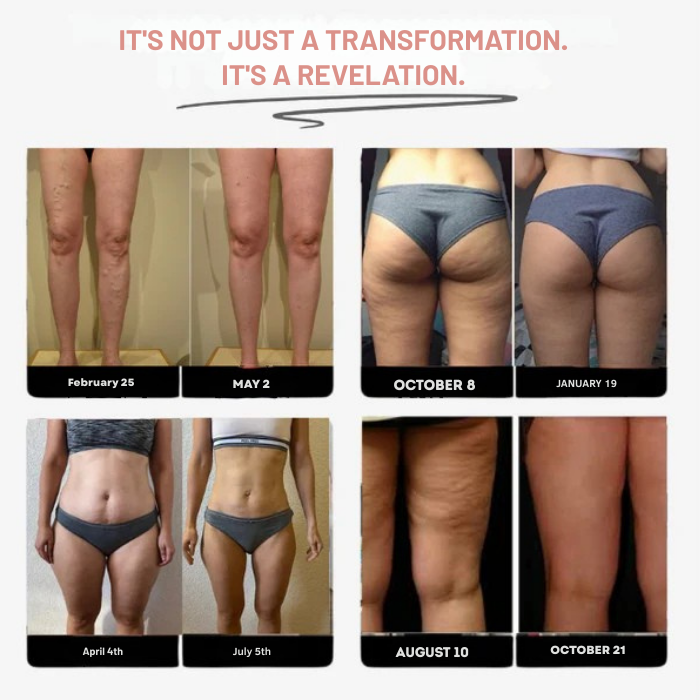 ViviSculpt™ Leggings — Sculpt Muscle-Powered Legs That Turn Heads Every Day