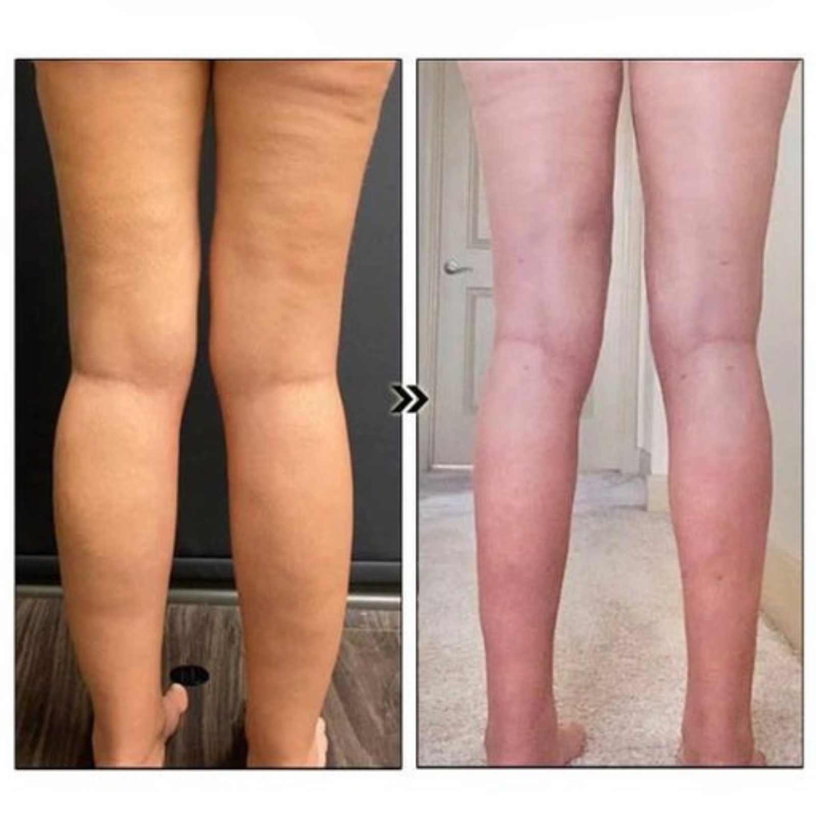 LumiVive™ Magnetic Therapy Earrings — Feel Lighter, Energized, and Stress-Free Every Day