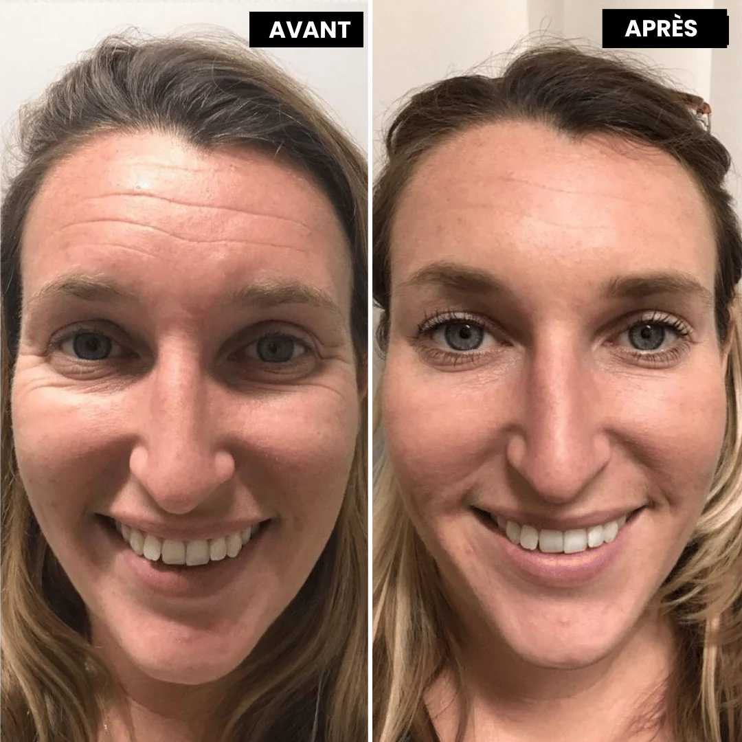 VitaFirm™ Duo — Unlock Firm, Radiant Skin That Turns Back Time