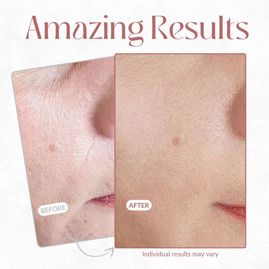 RadiantLift™ — Unleash Youthful Skin That Commands Every Glance