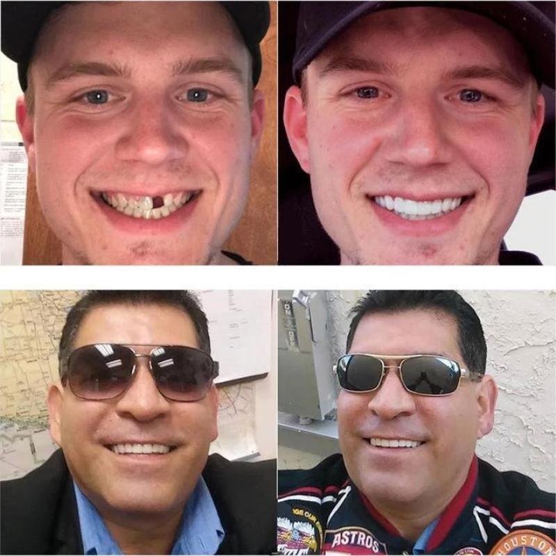 FlairFit™ Smile Shapers — Instantly Own a Confident, Flawless Smile Without the Dentist