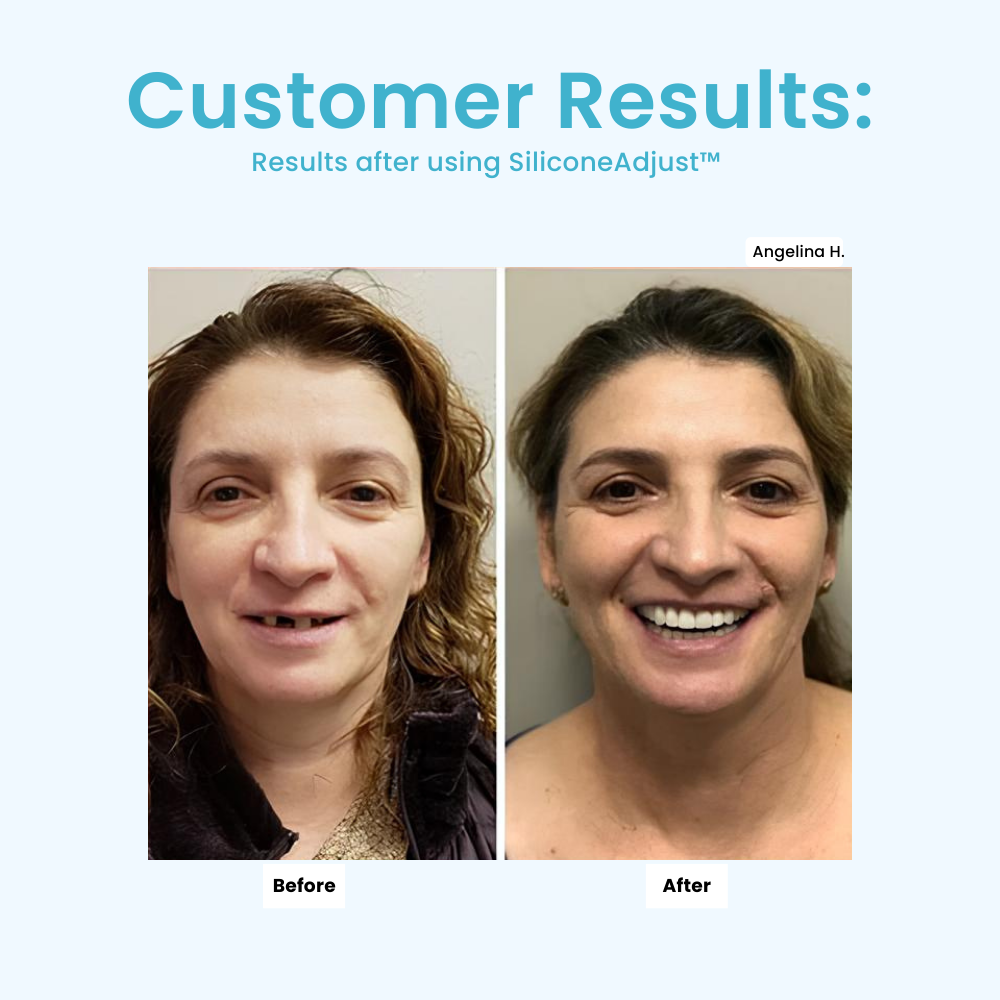 ComfortMold™ — Experience Pain-Free Denture Comfort That Feels Made Just for You