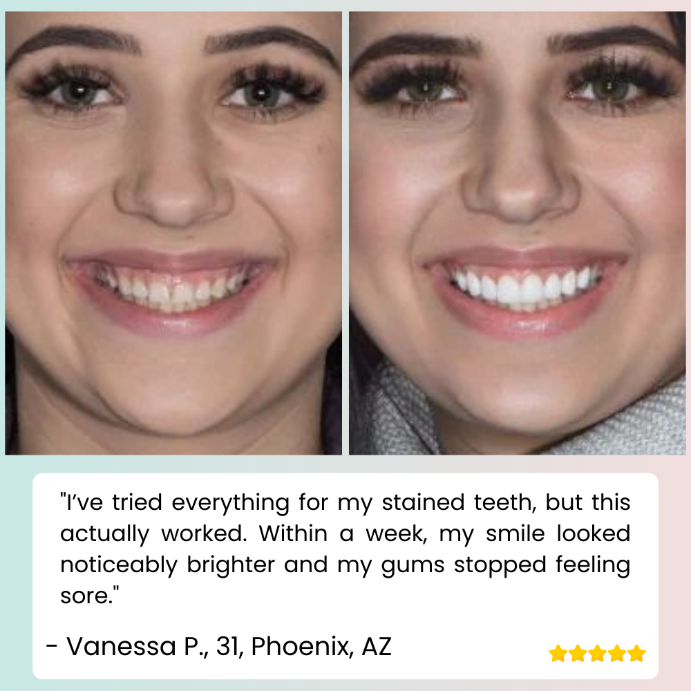 LumaCrest™ — Unleash a Radiant Smile and Heal Your Gums for Lasting Confidence