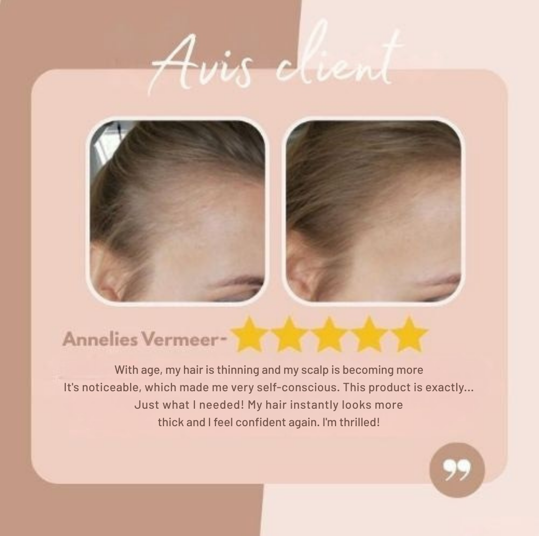 LumaVeil™ — Unlock Flawless, Natural-Looking Hair That Boosts Your Confidence Instantly