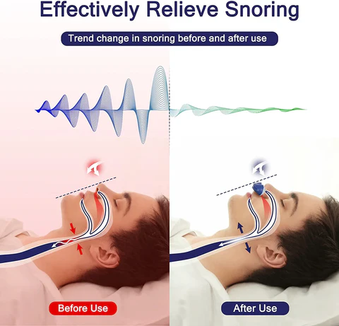 Portable CPAP Machine for Snoring Relief and Sleep Apnea Treatment