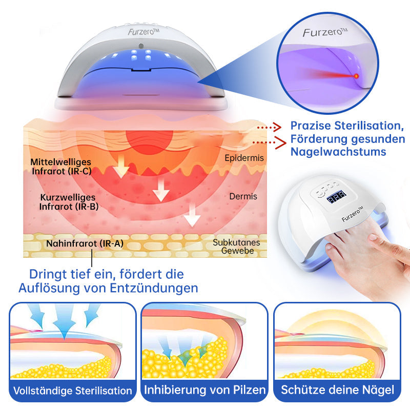 PureNail | Nail Fungus Laser Therapy Device - Your Secret Weapon Against Nail Fungus