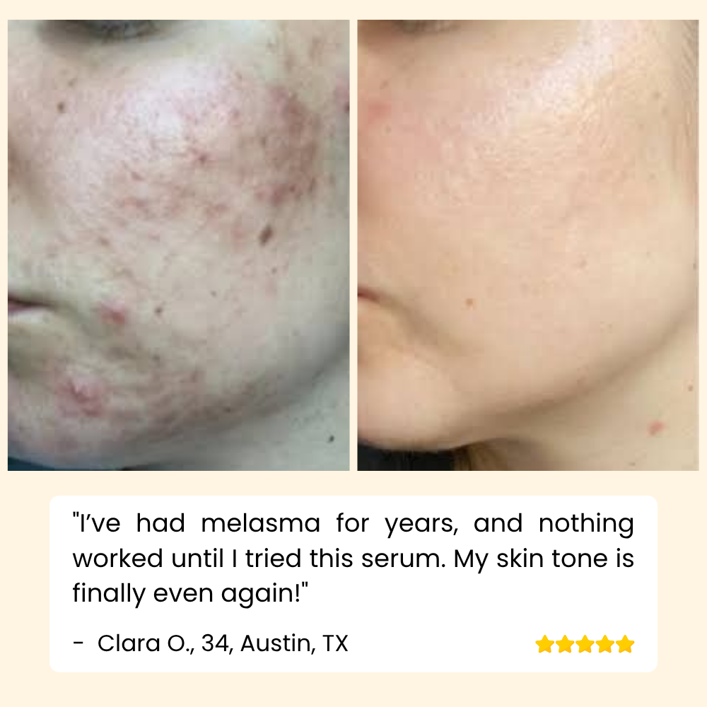 EELHOE Eternity™ — Erase Dark Spots, Reveal Glowing Skin | 1+1 FREE