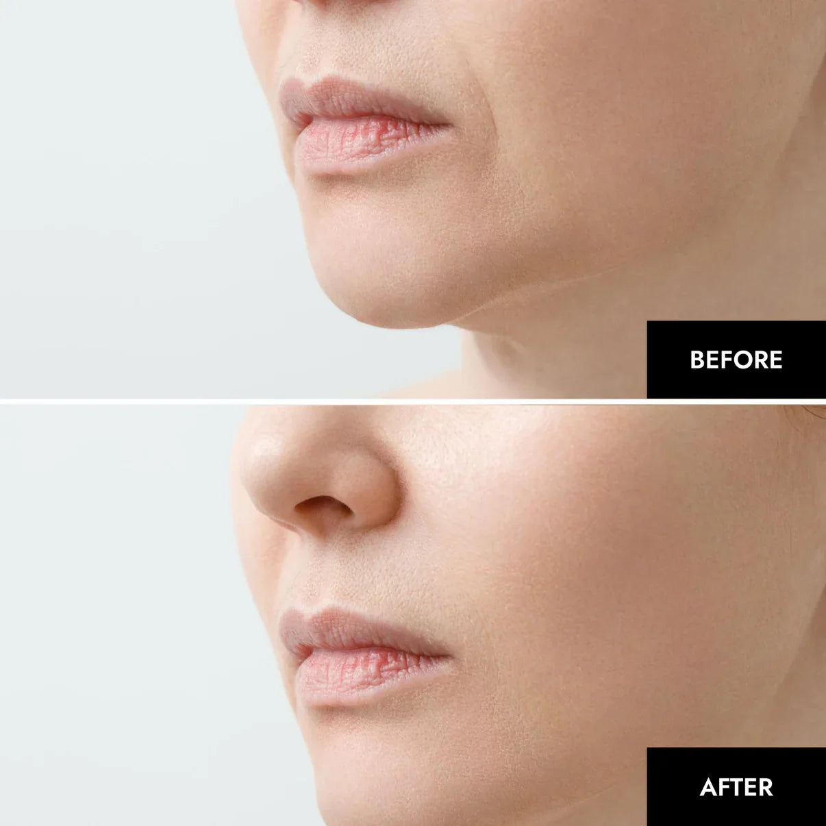 RejuviSkin™ — Unleash Radiant, Youthful Glow That Turns Heads Instantly