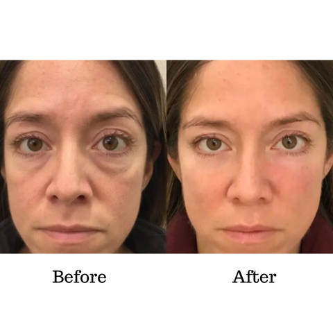 RambleaLift™ — Instantly Restore Youthful, Radiant Eyes That Stop Time