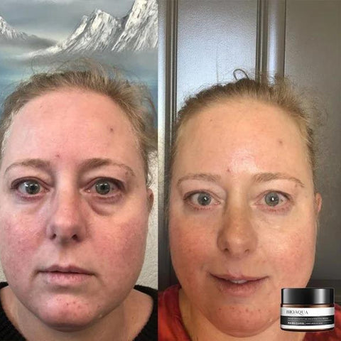 RamoraRadiance™ — Reveal Brighter, Youthful Eyes That Command Attention