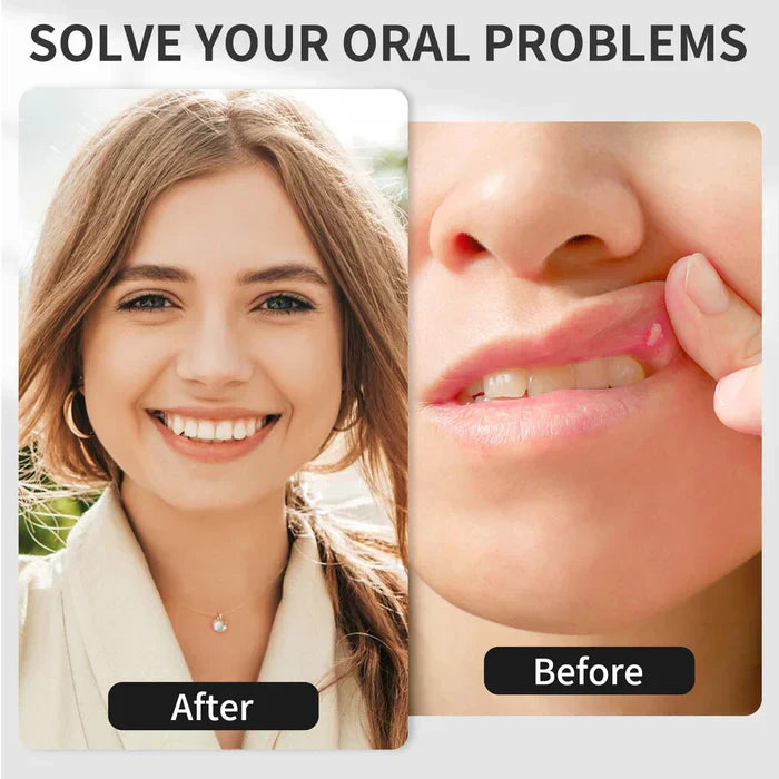 Red Light Therapy Device for Oral Care at Home