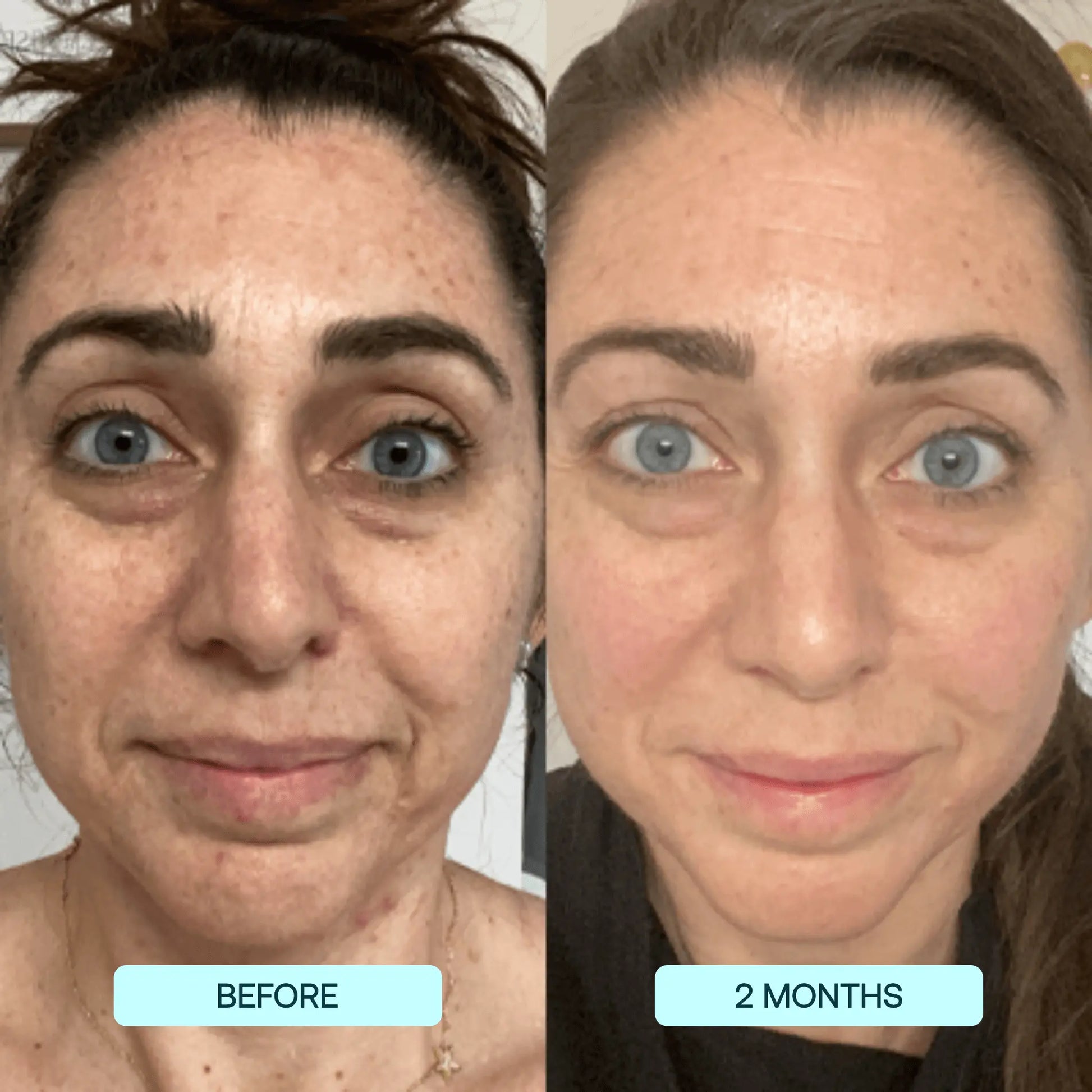 RejuviSkin™ — Unleash Radiant, Youthful Glow That Turns Heads Instantly