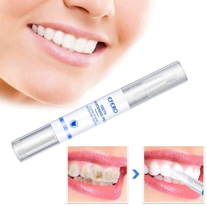RadiancePro™ Teeth Whitener — Instantly Brighten Your Smile Without Sensitivity