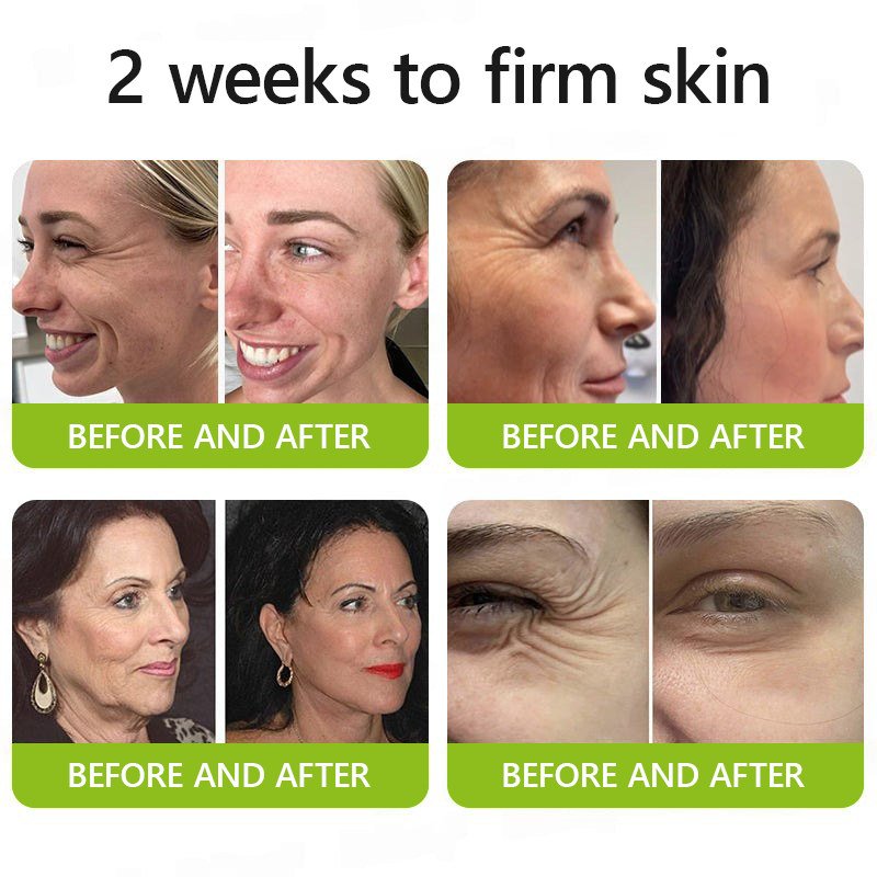 ReviRadiance™ — Unlock Youthful Lift and Radiance Without Needles or Waiting