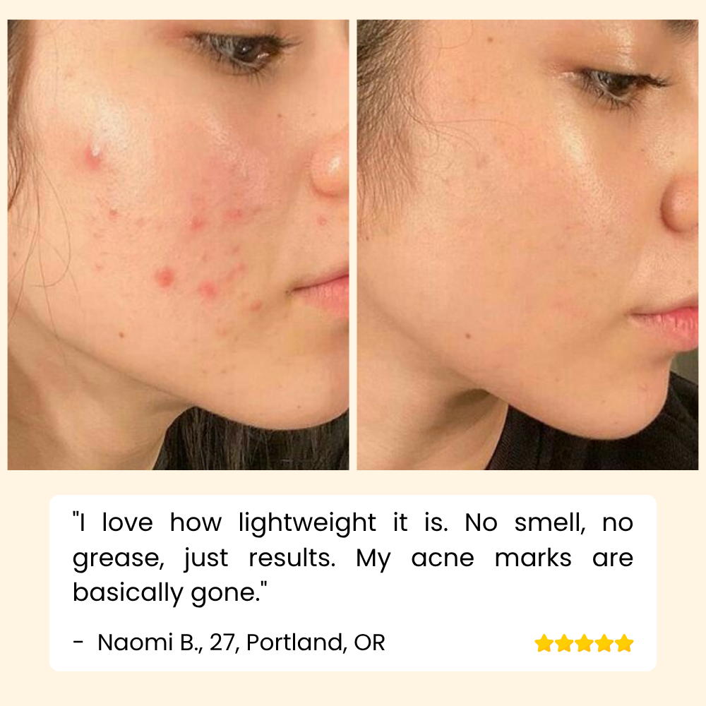 EELHOE Eternity™ — Erase Dark Spots, Reveal Glowing Skin | 1+1 FREE