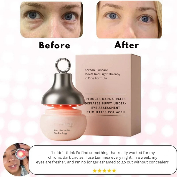 VioraLuxe™ — Revive Tired Eyes Fast for a Brighter, Youthful Glow Every Day