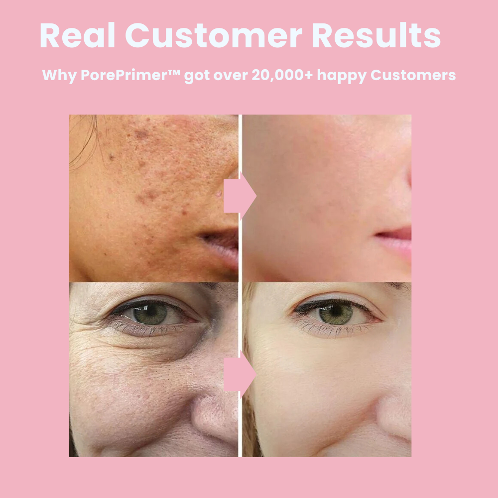 PorePrimer™ The invisible Poor Cream | FLASH SALE: 1+1 FREE