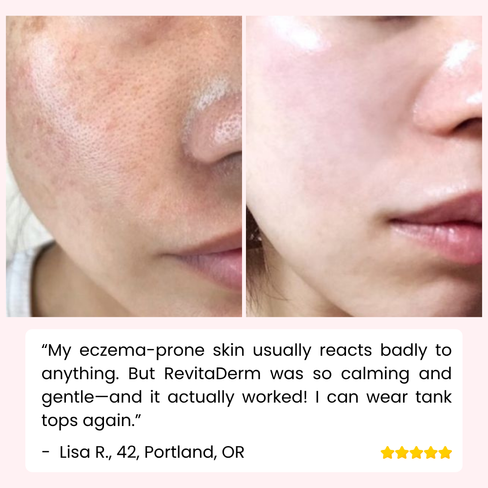 RevitaDerm™ — Unleash Radiant, Silky Skin and Banish Flaws for Good