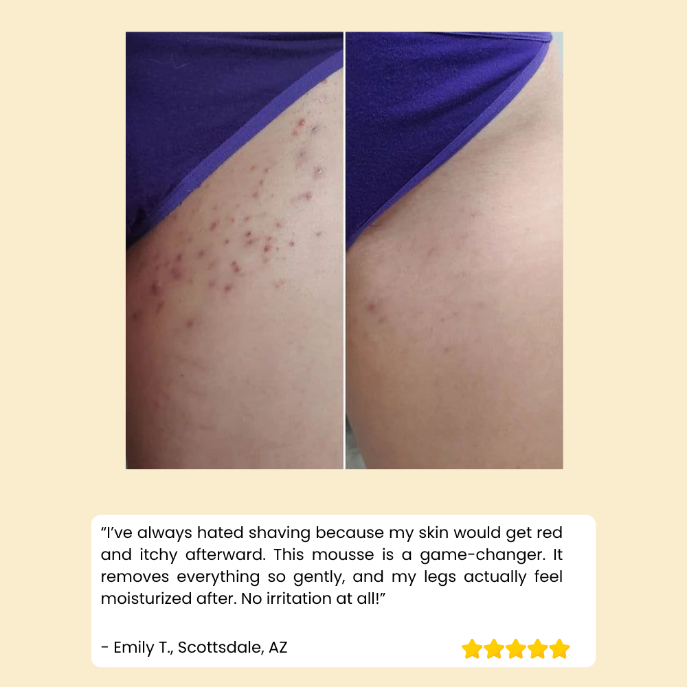 HoneyMousse™ — Experience Pain-Free, Irresistibly Smooth Skin That Lasts Weeks