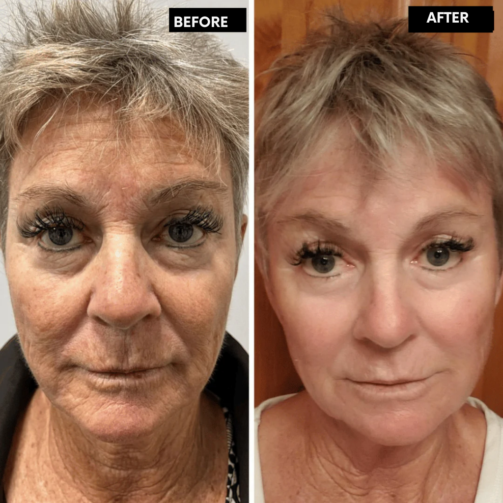 DermaVive™ — Unlock Firm, Radiant Skin That Turns Heads in Just 14 Days