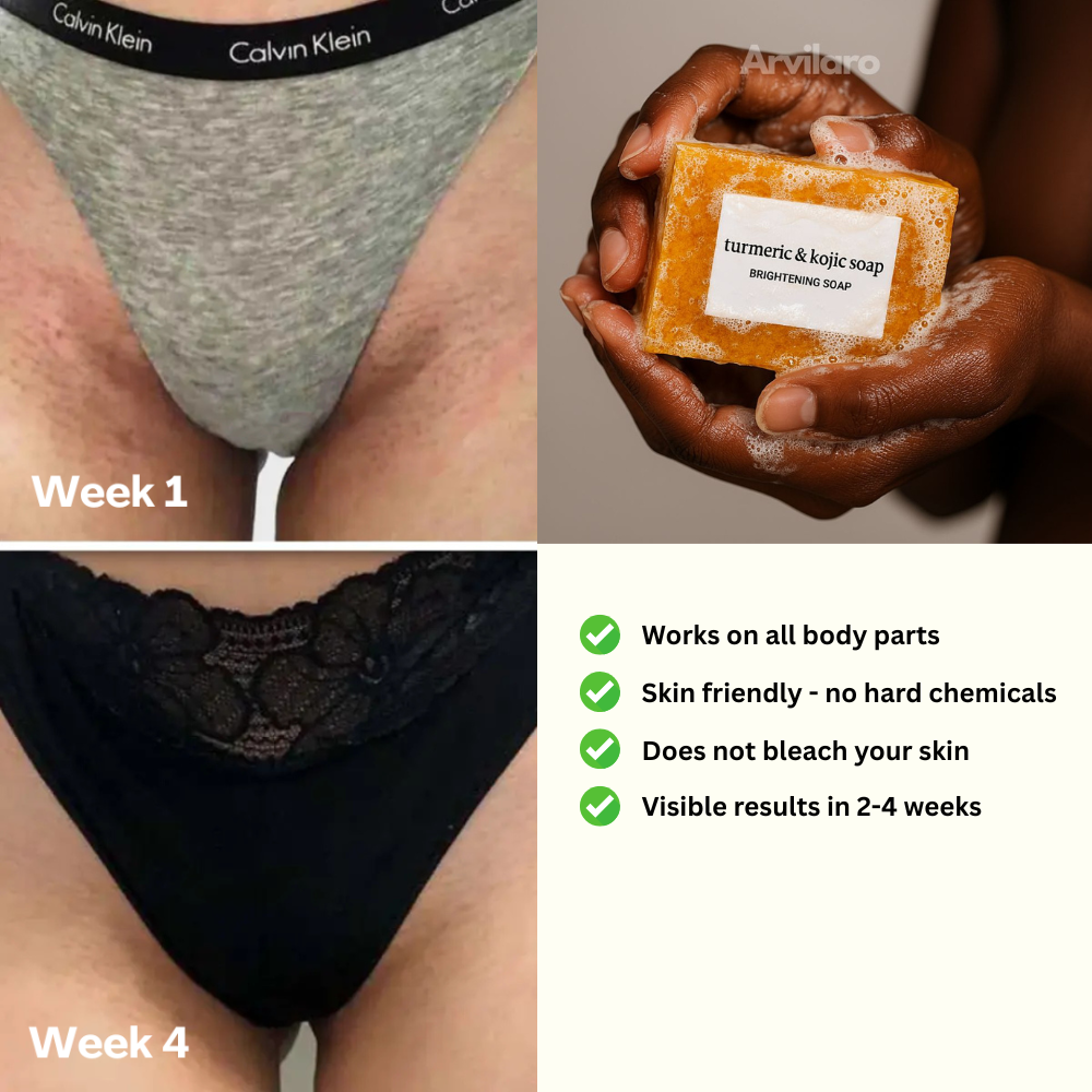 Kojic Acid & Turmeric Soap