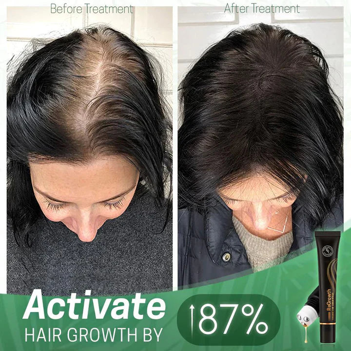 ViraCrest™ — Transform Your Thinning Hair Into a Lush, Head-Turning Crown