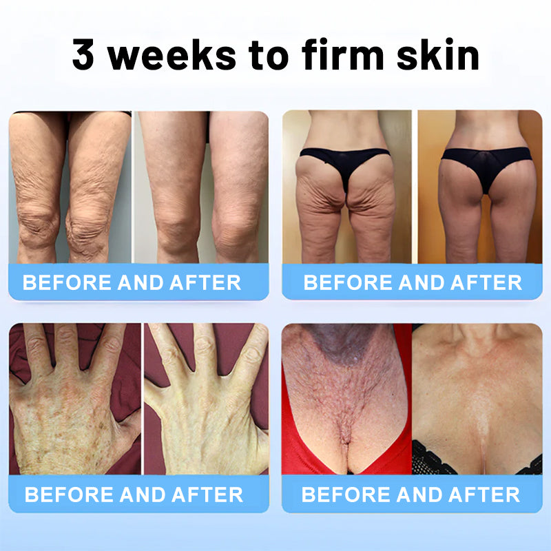 VelaRise™ Tightening Stick — Instantly Lift and Renew Your Youthful Glow Without Pain or Mess