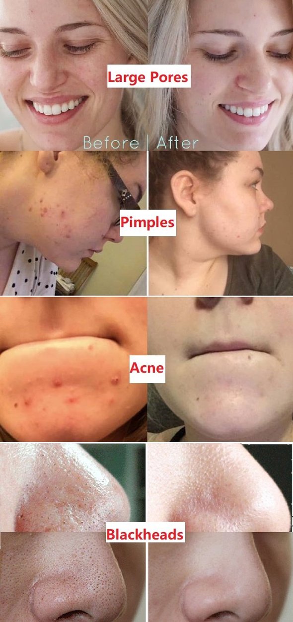 AuraPure™ Detox Mask Stick — Unlock Radiant, Shine-Free Skin That Turns Heads Every Time