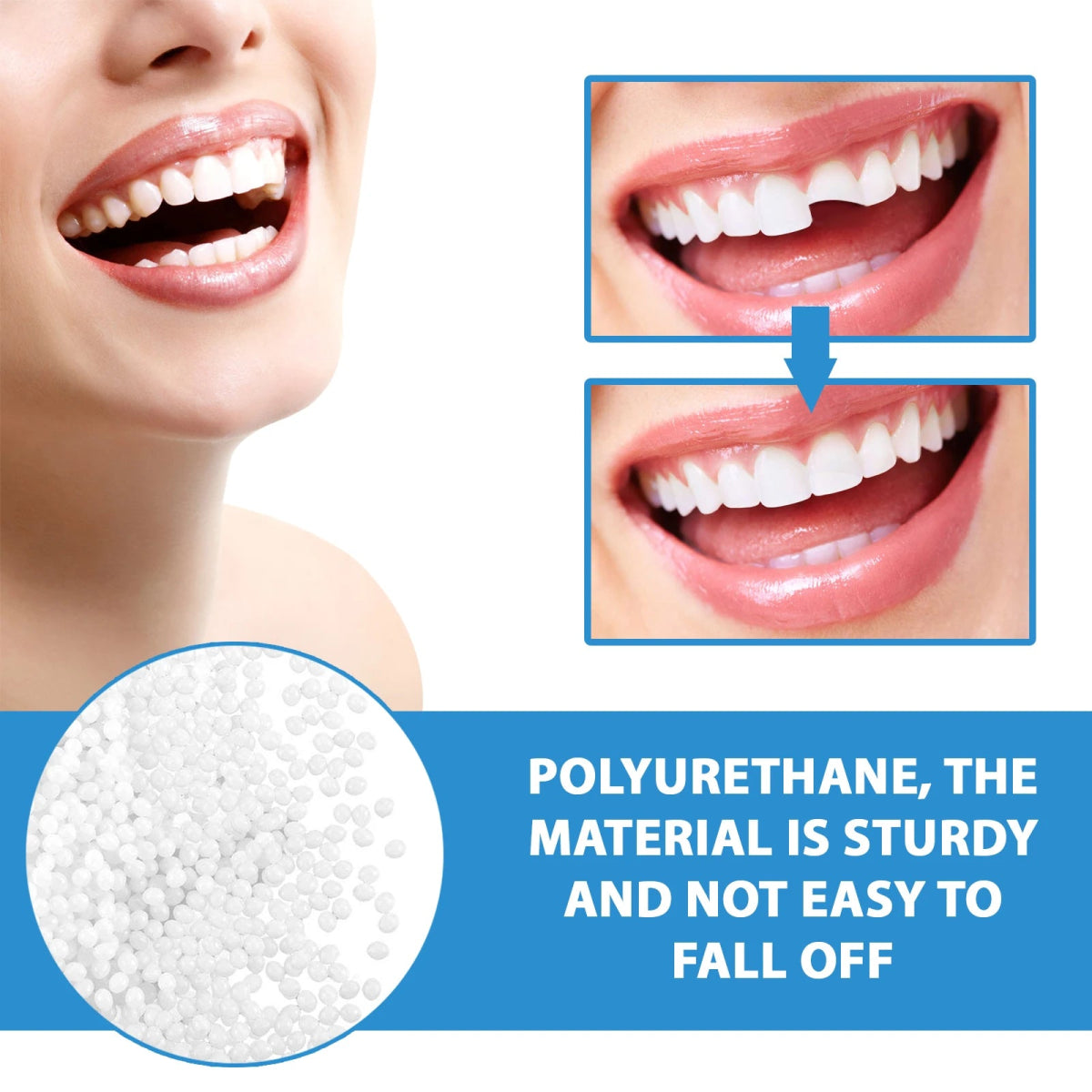InstantSmile™ — Confidently Fill Gaps and Shine Bright Anywhere, Anytime